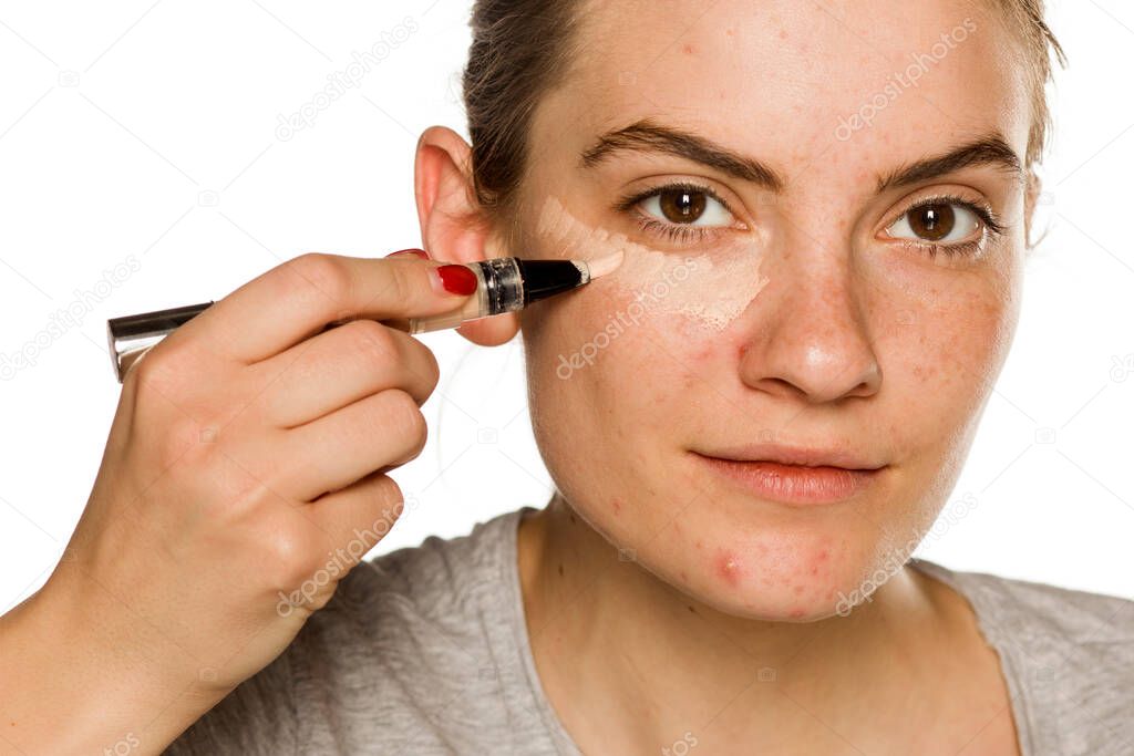 Young woman with problematic ckin applying concealer on white background