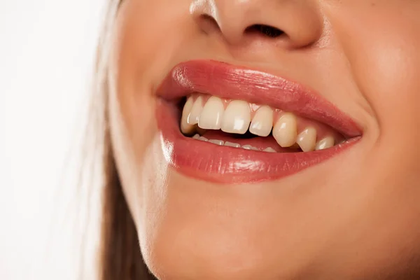 Mulher Sorridente Com Dentes Naturais Saudáveis — Fotografia de Stock