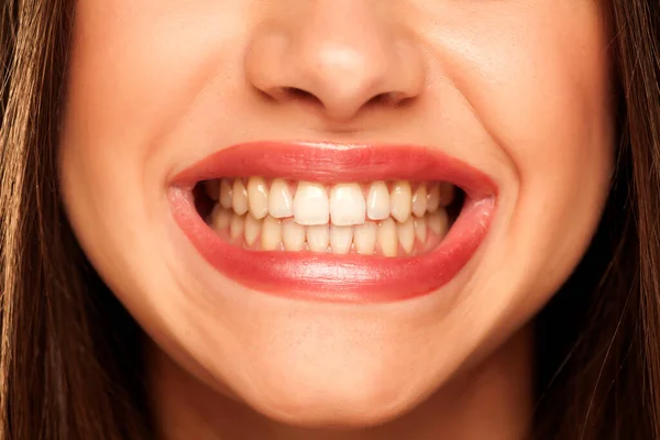 Młoda Kobieta Pokazuje Swoje Naturalne Zdrowe Zęby — Zdjęcie stockowe