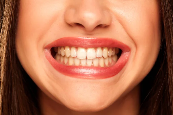 Mujer Joven Mostrando Sus Dientes Naturales Sanos —  Fotos de Stock