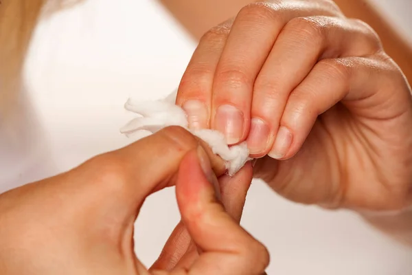 Woman Removing Nail Polish Cotton Pad Aceone — Stock Photo, Image