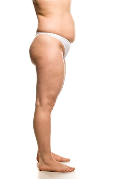 Vista Lateral Das Pernas Cintura Mulher Com Sobrepeso Fundo Branco — Fotografia de Stock