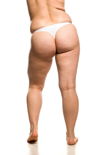 Buttocks Legs Waist Overweight Woman White Background — Stock Photo, Image