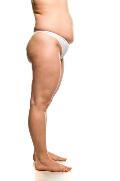 Vue Latérale Des Jambes Taille Femme Surpoids Sur Fond Blanc — Photo