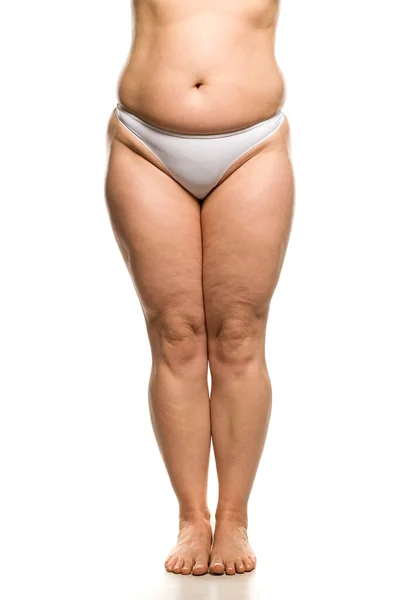 Buik Benen Taille Van Vrouw Met Overgewicht Witte Achtergrond — Stockfoto