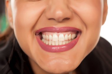 happy woman shows her beautiful white teeth clipart