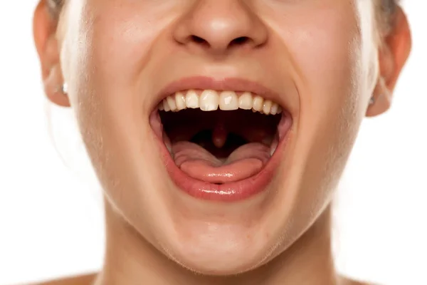 Young Woman Open Mouth White Background — Stock Photo, Image