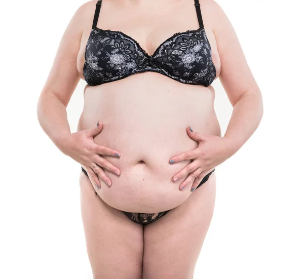医疗保健 医疗和超重的概念 闭合的妇女与脂肪腹部 超重的女性胃 腹部上的妊娠纹 大肚子是溃疡病的一个特征 — 图库照片