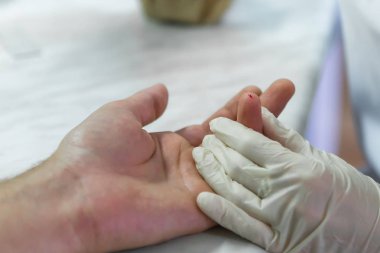 Parmak kan testi laboratuarda. Doktor bir parmak delip geçiyor. Yakın çekim.