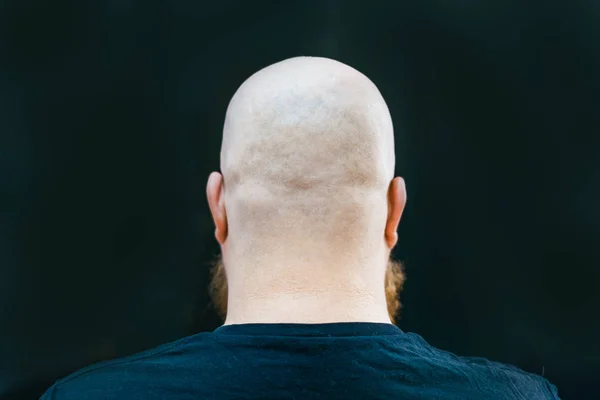 Close Cabeça Homem Careca Trás — Fotografia de Stock