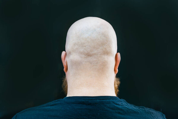 A close up of bald man's head from back side.