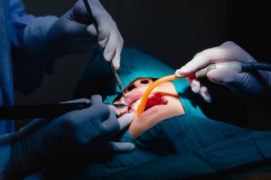 Diş hekimi ortak operasyon çocuk ağız temizliği.