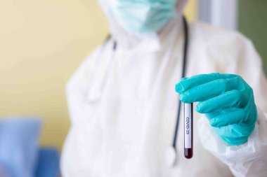 Kontrol bölgesindeki doktorun elindeki test tüpü kan örneğini kapat. COVID 19 'u olan hastalara bakım ve tedavi kavramları.