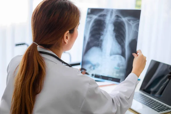 病院で患者の胸部X線フィルムを調べるアジアの若い女性医師 健康と医療の概念 — ストック写真