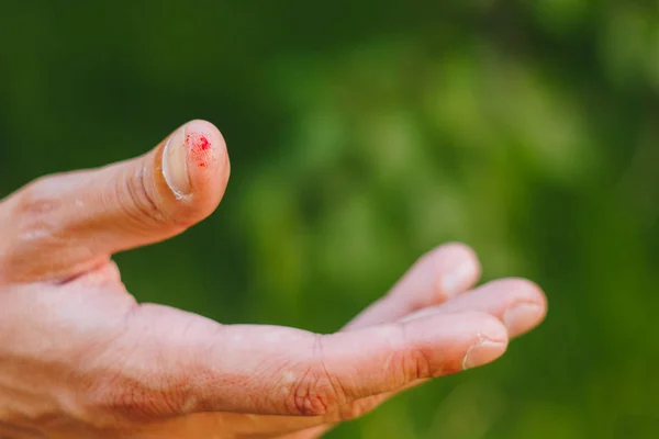 Bloed op een vinger op een vage groene achtergrond van gras en bomen. Wrede hand van een harde werker. Close-up. Callus aan kant. — Stockfoto