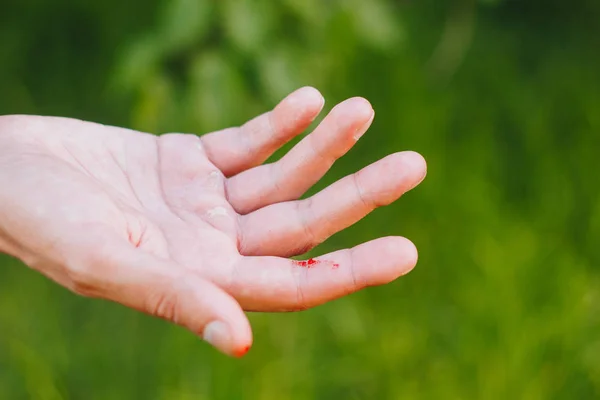 Sang sur un doigt sur un fond vert flou d'herbe et d'arbres. Main dure d'un travailleur acharné. Gros plan. callus à portée de main . — Photo