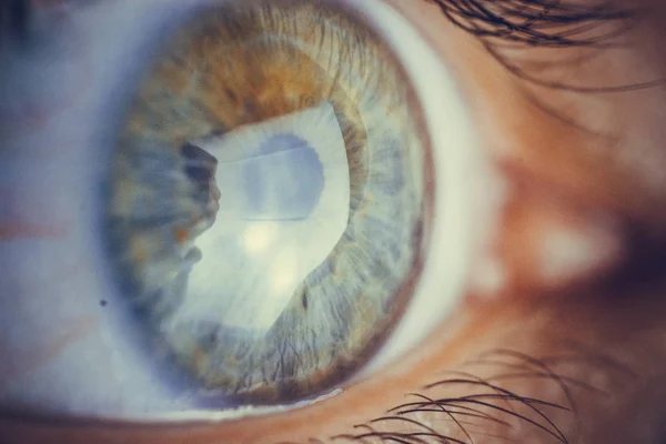Oczy makro z pęknięcie czerwonych naczyń krwionośnych. oko pokryte krwią bliska. Problemy z widzeniem. — Zdjęcie stockowe