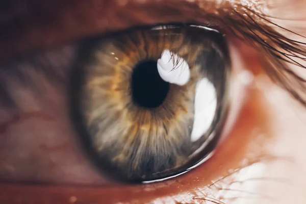 Macroojos con vasos sanguíneos rojos reventados. globo ocular cubierto de sangre de cerca. problemas de visión . —  Fotos de Stock