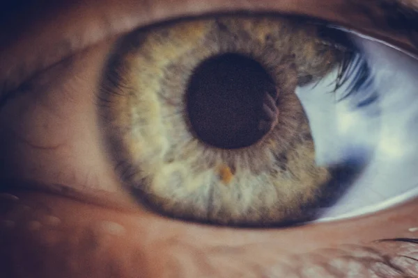 Oczy makro z pęknięcie czerwonych naczyń krwionośnych. oko pokryte krwią bliska. Problemy z widzeniem. szeroko otwarte oko. — Zdjęcie stockowe