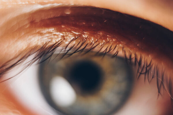 макроглаза с разрывающимися красными кровеносными сосудами. Глазное яблоко, покрытое кровью. проблемы со зрением. широкий открытый глаз
.