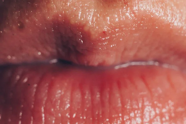 Rosa pralle natürliche weibliche Lippen funkeln in Großaufnahme. Ohne Make-up. Gesichts- und Lippenpflege — Stockfoto