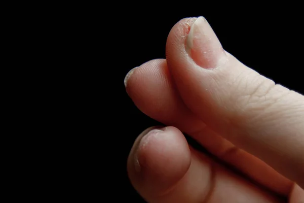 Dedos de una mano femenina con una macro de uñas corta, limpia y clara. primer plano de palma blanca aislada sobre fondo negro. espacio de copia —  Fotos de Stock