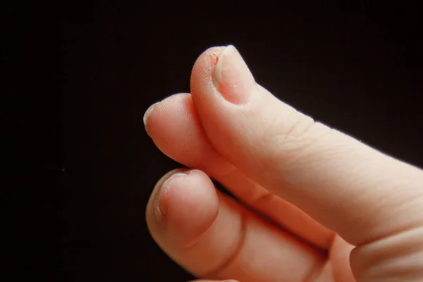 짧고 깨끗하고 명확한 손톱 매크로를 가진 여성의 손의 손가락. 검은 색 배경에 격리 된 흰색 손바닥 클로즈업. 복사 공간 — 스톡 사진