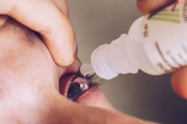 bir adam parlak kırmızı arterler ile açık insan gözü damlaları yakından görme geliştirmek için damla. tahriş ve göz küresi kızarıklık. gözbebekleri, iris, makro kirpikler. görme sorunları