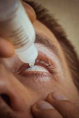 bir adam parlak kırmızı arterler ile açık insan gözü damlaları yakından görme geliştirmek için damla. tahriş ve göz küresi kızarıklık. gözbebekleri, iris, makro kirpikler. görme sorunları