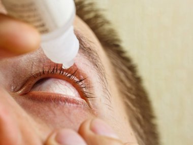 bir adam parlak kırmızı arterler ile açık insan gözü damlaları yakından görme geliştirmek için damla. tahriş ve göz küresi kızarıklık. gözbebekleri, iris, makro kirpikler. görme sorunları