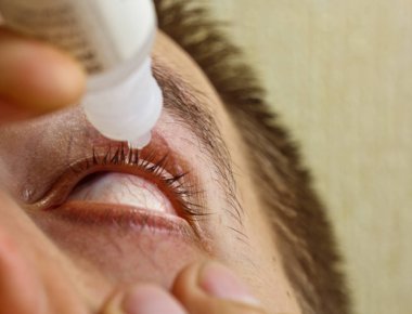 bir adam parlak kırmızı arterler ile açık insan gözü damlaları yakından görme geliştirmek için damla. tahriş ve göz küresi kızarıklık. gözbebekleri, iris, makro kirpikler. görme sorunları