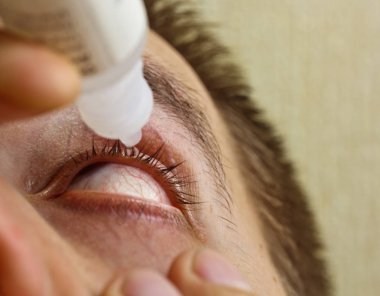 bir adam parlak kırmızı arterler ile açık insan gözü damlaları yakından görme geliştirmek için damla. tahriş ve göz küresi kızarıklık. gözbebekleri, iris, makro kirpikler. görme sorunları