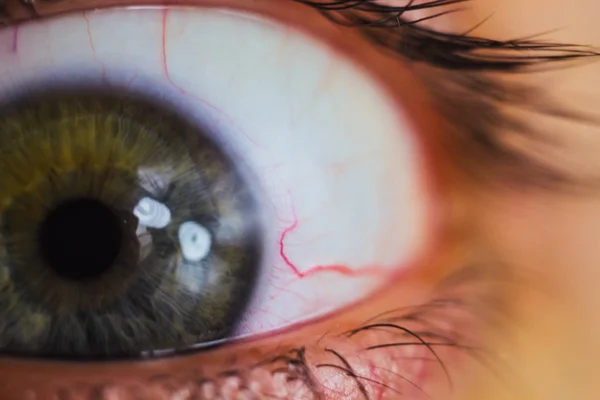 Occhio umano spalancato con arterie rosso vivo da vicino. irritazione e arrossamento del bulbo oculare. pupille, iride, ciglia in macro — Foto Stock