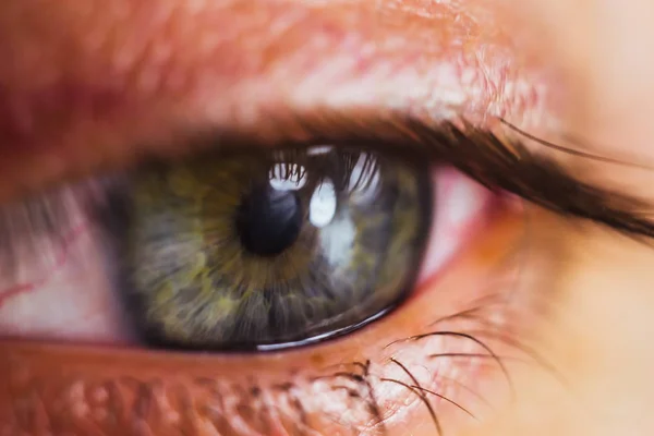 Aprire l'occhio umano con arterie rosso vivo da vicino. irritazione e arrossamento del bulbo oculare. pupille, iride, ciglia in macro. problemi di vista — Foto Stock