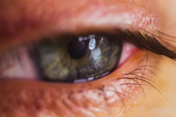 Ojo humano abierto con arterias rojas brillantes de cerca. irritación y enrojecimiento del globo ocular. pupilas, iris, pestañas en macro. problemas de visión — Foto de Stock