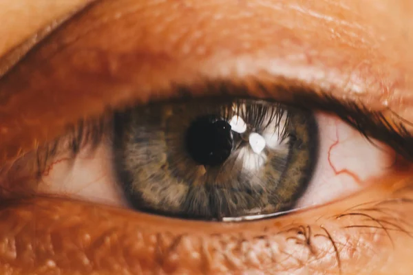 Ojo humano abierto con arterias rojas brillantes de cerca. irritación y enrojecimiento del globo ocular. pupilas, iris, pestañas en macro. problemas de visión —  Fotos de Stock