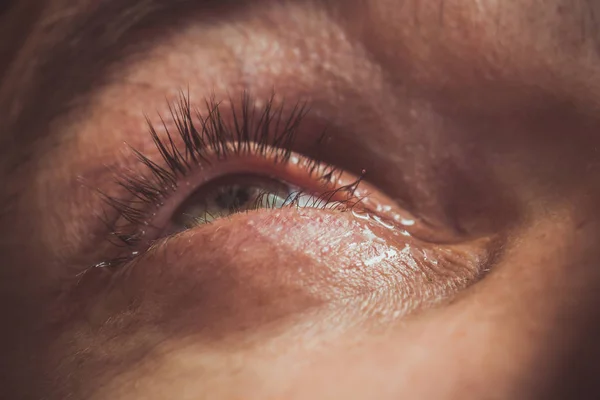 Un hombre gotea ojo humano abierto con las gotas de las arterias rojas brillantes para mejorar la visión de cerca. irritación y enrojecimiento del globo ocular. pupilas, iris, pestañas en macro. problemas de visión — Foto de Stock