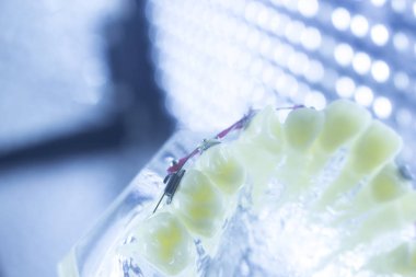 Ortodonti diş hekimleri öğretim modeli diş diş plastik ve metal köşeli parantez her diş düzleştirmek için aligners.