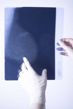 Tıbbi hastane mamografi x-ray meme kanseri mamografi inceden inceye gözden geçirmek.