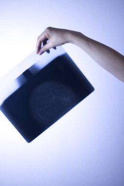 Tıbbi hastane mamografi x-ray meme kanseri mamografi inceden inceye gözden geçirmek.