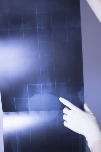Röntgenbild Des Krankenhauses Lowe Rückenschmerzen Wirbelsäule Und Hüfte Traumatologie Scan — Stockfoto