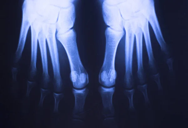 Hôpital Médical Radiographie Pieds Traumatologie Scan — Photo