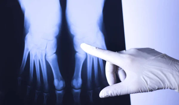 Medical Hospital Ray Feet Traumatology Scan — Stock Photo, Image