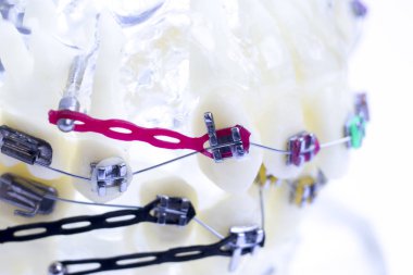 Diş metal diş teli Ortodonti modeli öğretim diş telini aligners.