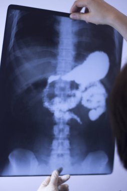 Tıbbi hastane röntgen lowe geri ağrı da mide ve organları gösteren omurga ve kalça Travmatoloji tarama.