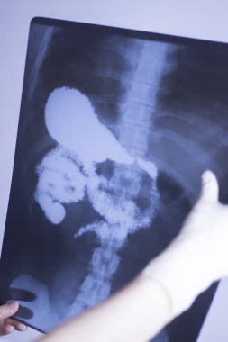 Tıbbi hastane röntgen lowe geri ağrı da mide ve organları gösteren omurga ve kalça Travmatoloji tarama.