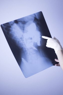 Tıbbi hastane röntgen lowe geri ağrı da mide ve organları gösteren omurga ve kalça Travmatoloji tarama.
