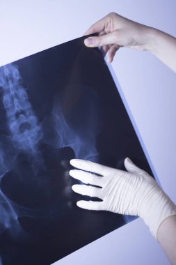 Tıbbi hastane röntgen lowe sırt ağrısı omurga ve kalça Travmatoloji tarama.