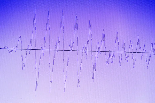 Audio sound wave studio editing computer program screen showings sounds on screen from vocal recording of voiceover.