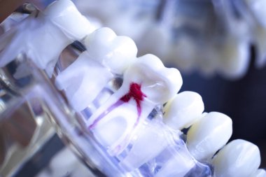 Diş hekimi diş diş modeli gösteren öğretim her diş ve dişeti hastalar ve öğrenciler için.